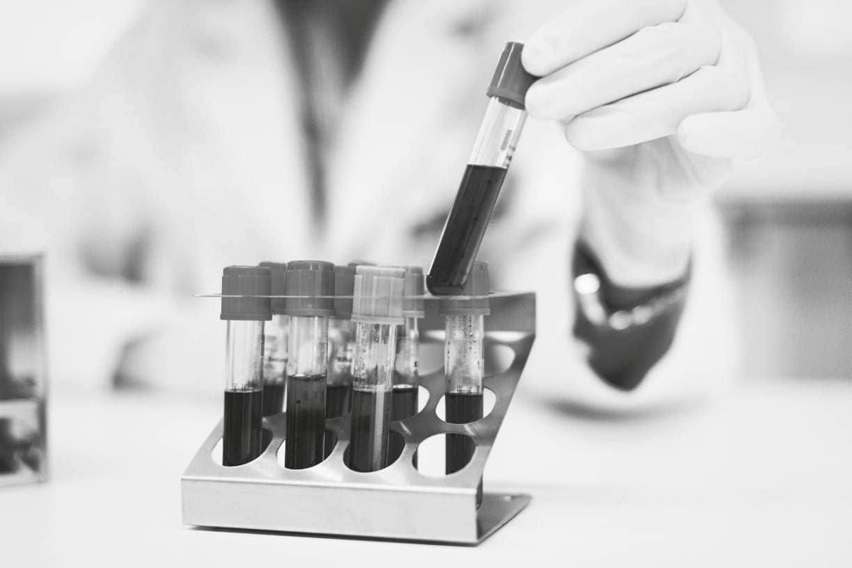 Tubos con muestra de sangre