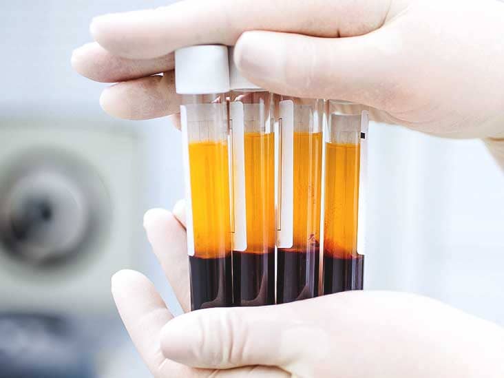 Tubos con Plasma Rico en Plaquetas